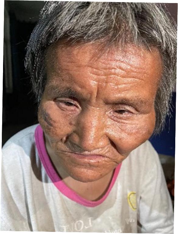 走失者照片 周口市寻亲：七旬老太被救助，穿白色...