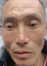 走失者照片 新乡市寻亲：六旬老人被救助，自述叫...