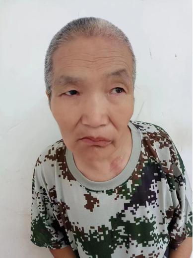 走失者照片 济南市寻亲:六旬老太被救助多年,嘴...