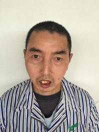 走失者照片 宣城市寻亲：五旬男子被救助，高1米...