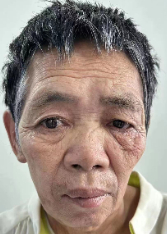 走失者照片 驻马店市寻亲：五旬女子被救助，穿白...