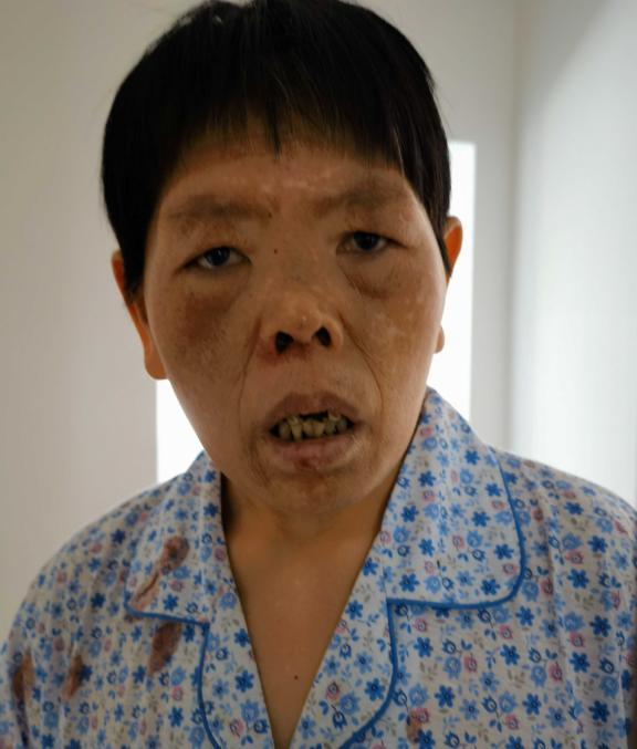走失者照片 昆明市寻亲：五旬女子被救助，高1米...
