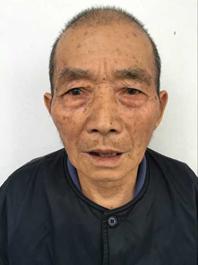 走失者照片 宣城市寻亲：八旬老人被救助多年，自...