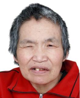 走失者照片 济南市寻亲：六旬老太被救助多年，嘴...