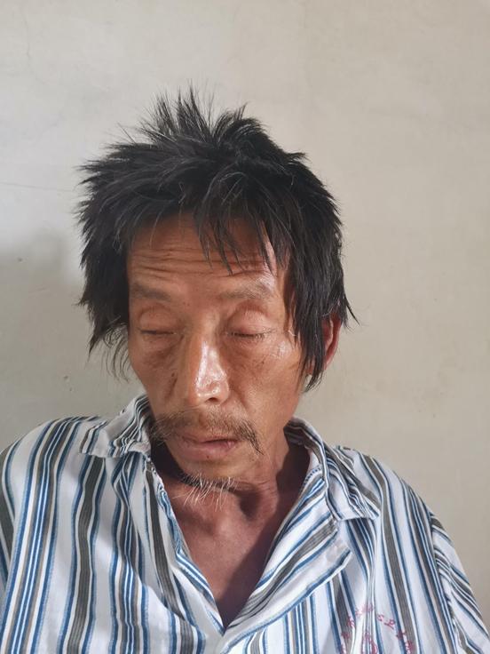 走失者照片 江门市寻亲：五旬男子在开平市被救助...