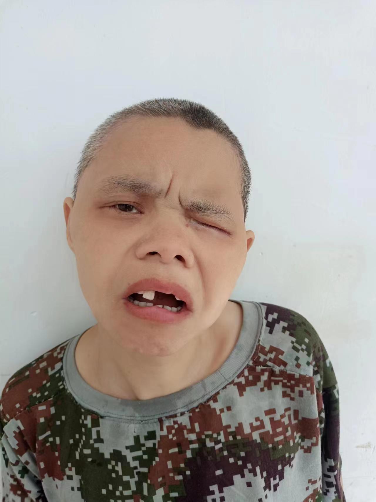 走失者照片 济南寻亲：中年女子被救助十余年，自...