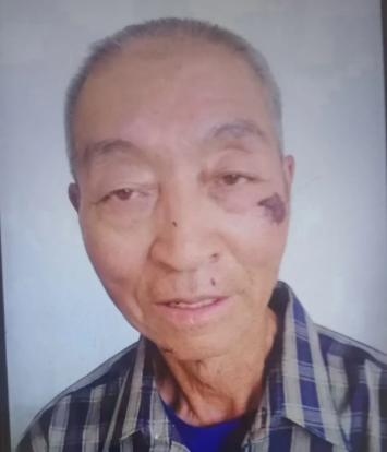 走失者照片 通辽市急寻：七旬老人走失，患小脑萎...