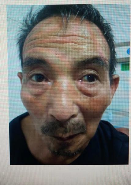 走失者照片 衡阳市耒阳市寻亲：五旬男子被救助，...