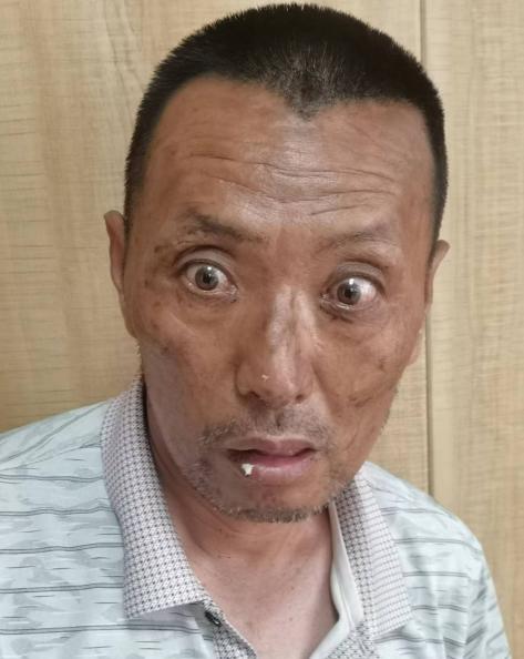 走失者照片 石嘴山市寻人：五旬男子被救助，自述...