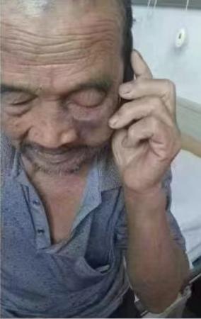 走失者照片 温州寻人：八旬老人失联，穿深灰色夹...