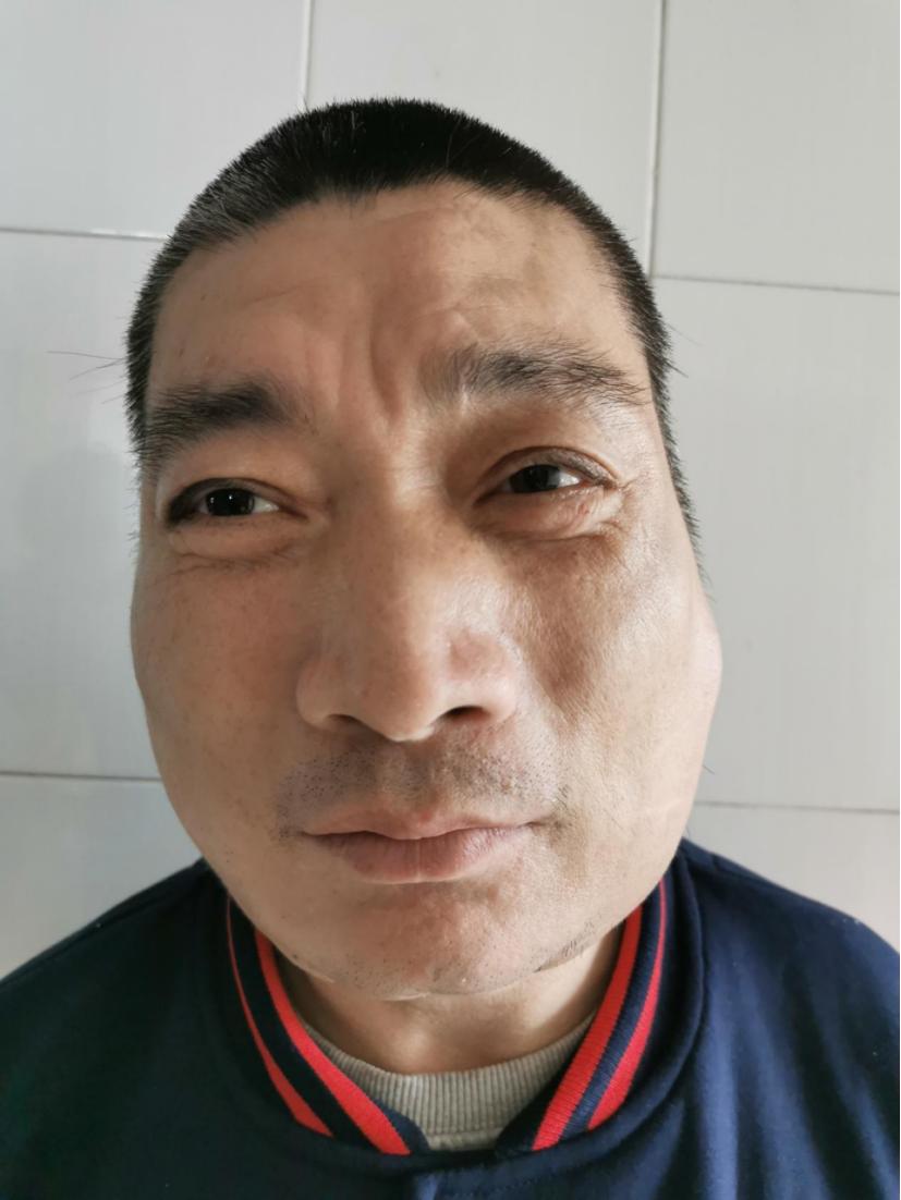 走失者照片 南京市寻亲：中年男子被救助多年，自...