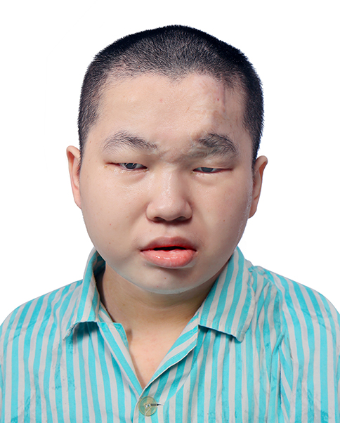 走失者照片 中山寻亲：青年男子被救助，精神异常...