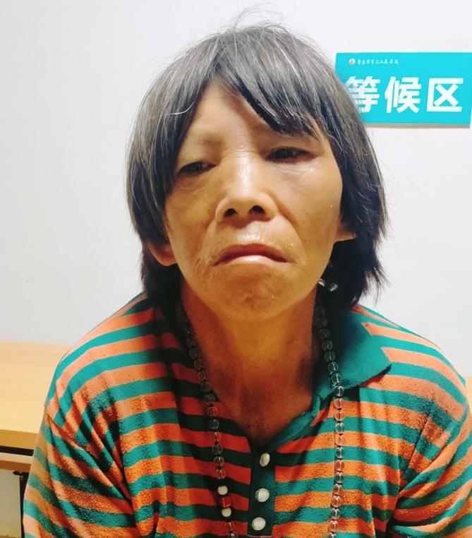 走失者照片 崇左寻亲：五旬女子被救助，穿条纹衣...