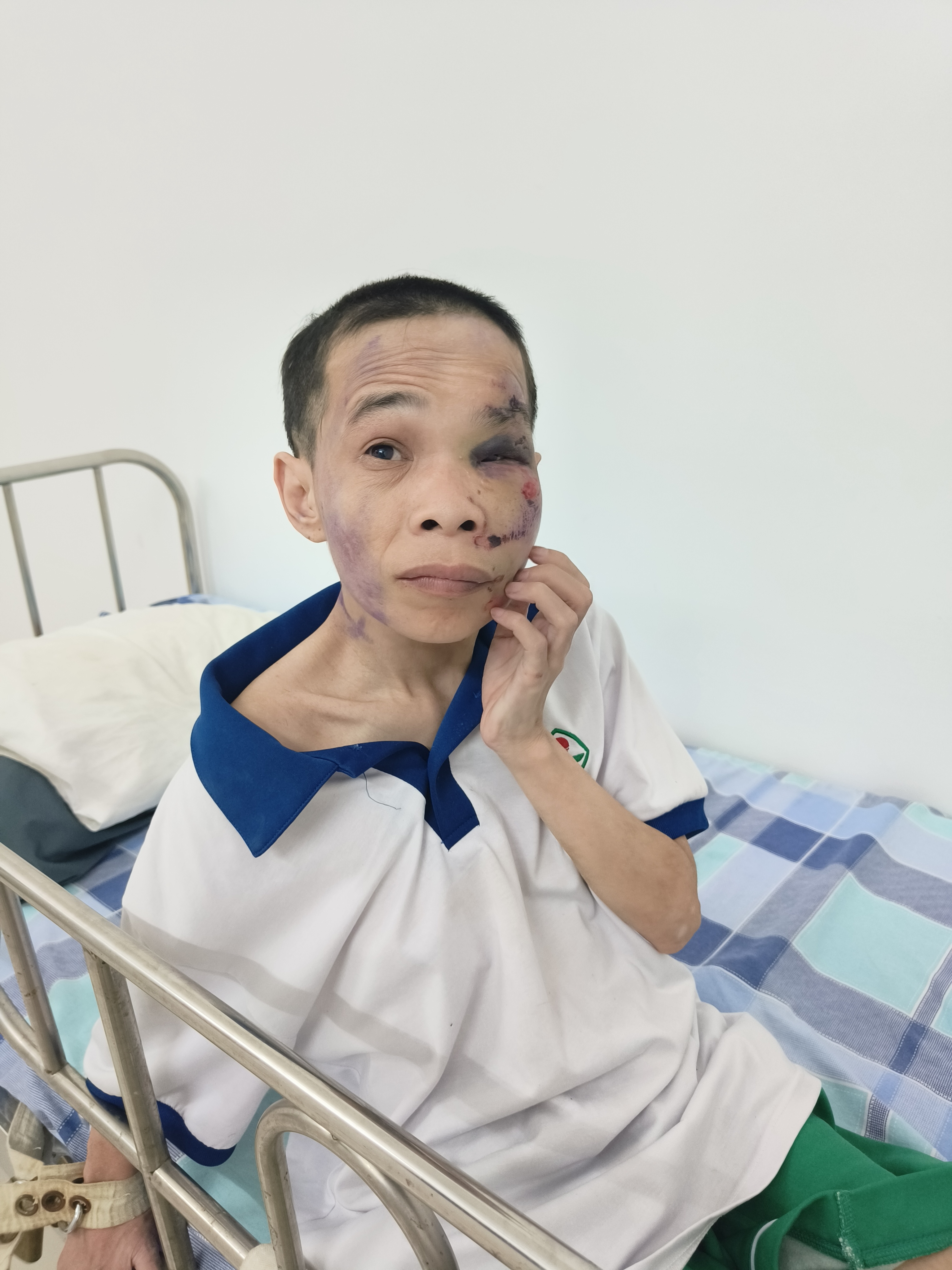 走失者照片 肇庆寻亲：五旬女子被救助，穿白色带...