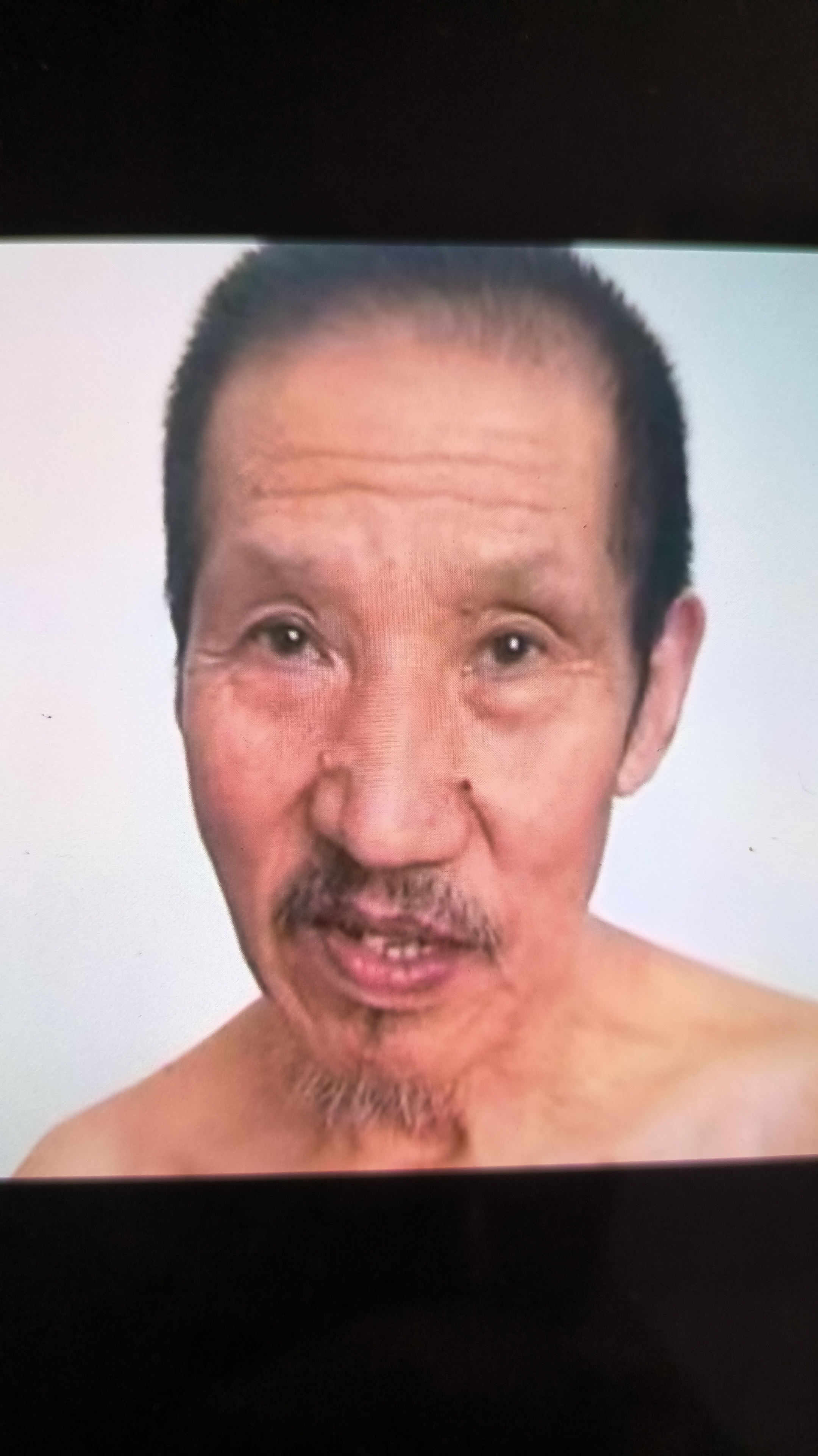 走失者照片 天津寻人！七旬老人走失，患小脑萎缩...