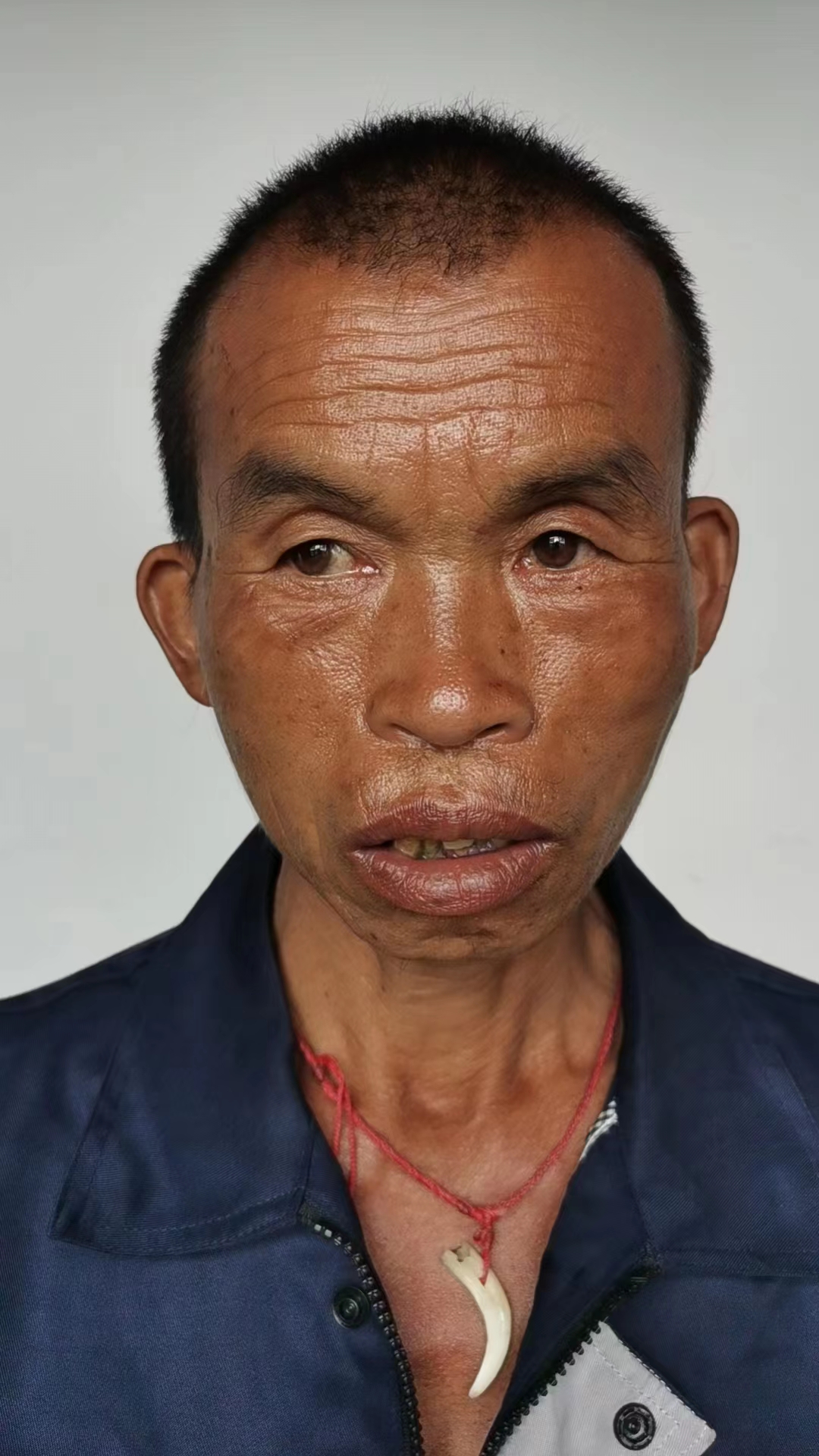 走失者照片 宜昌寻亲：中年男子被救助，自述叫潘...
