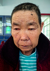 走失者照片 凉山州寻亲：六旬老太被救助，高1米...