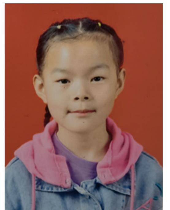 走失者照片 揭阳寻亲：7岁女孩自幼被救助