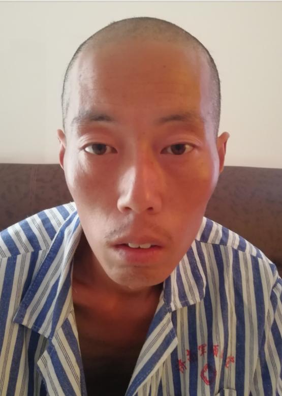 走失者照片 济南寻亲：青年男子被救助，高1米7...