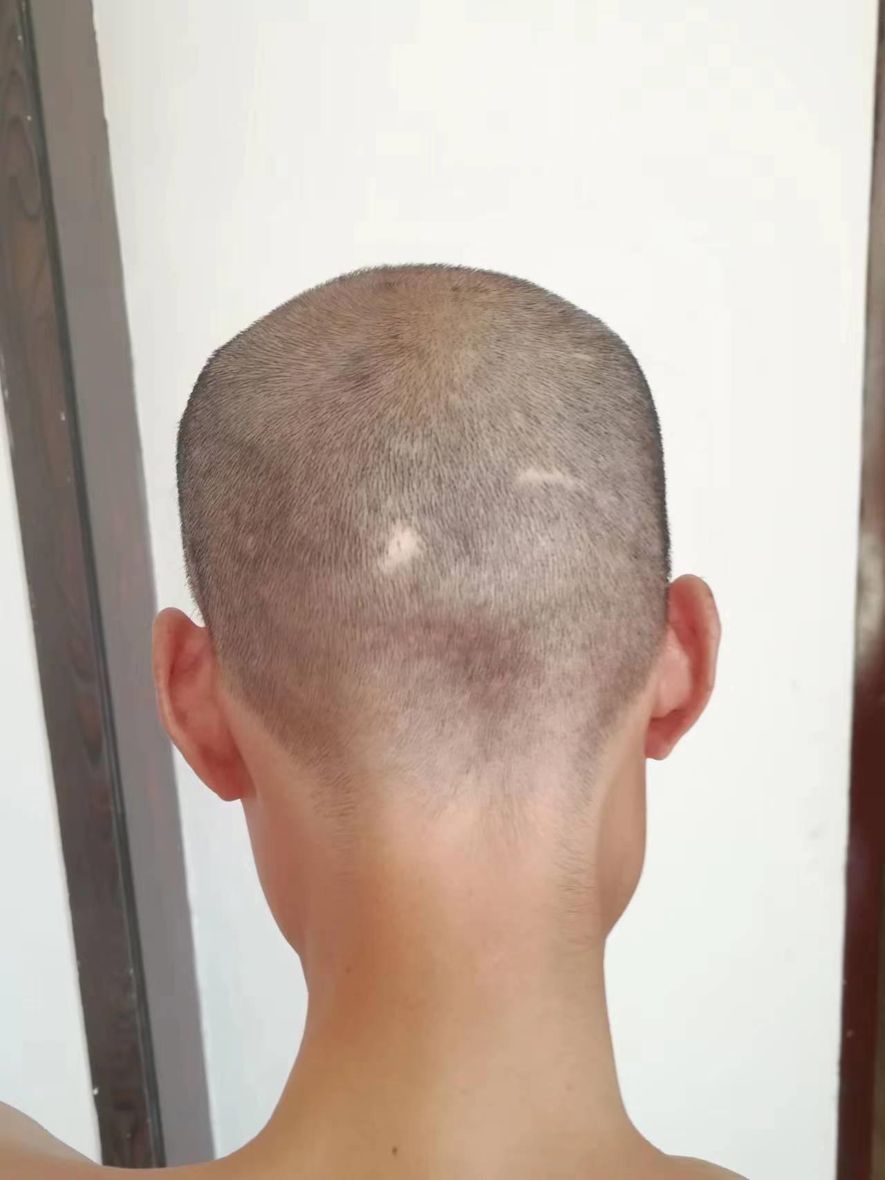 走失者照片 济南寻亲：青年男子被救助，高1米7...