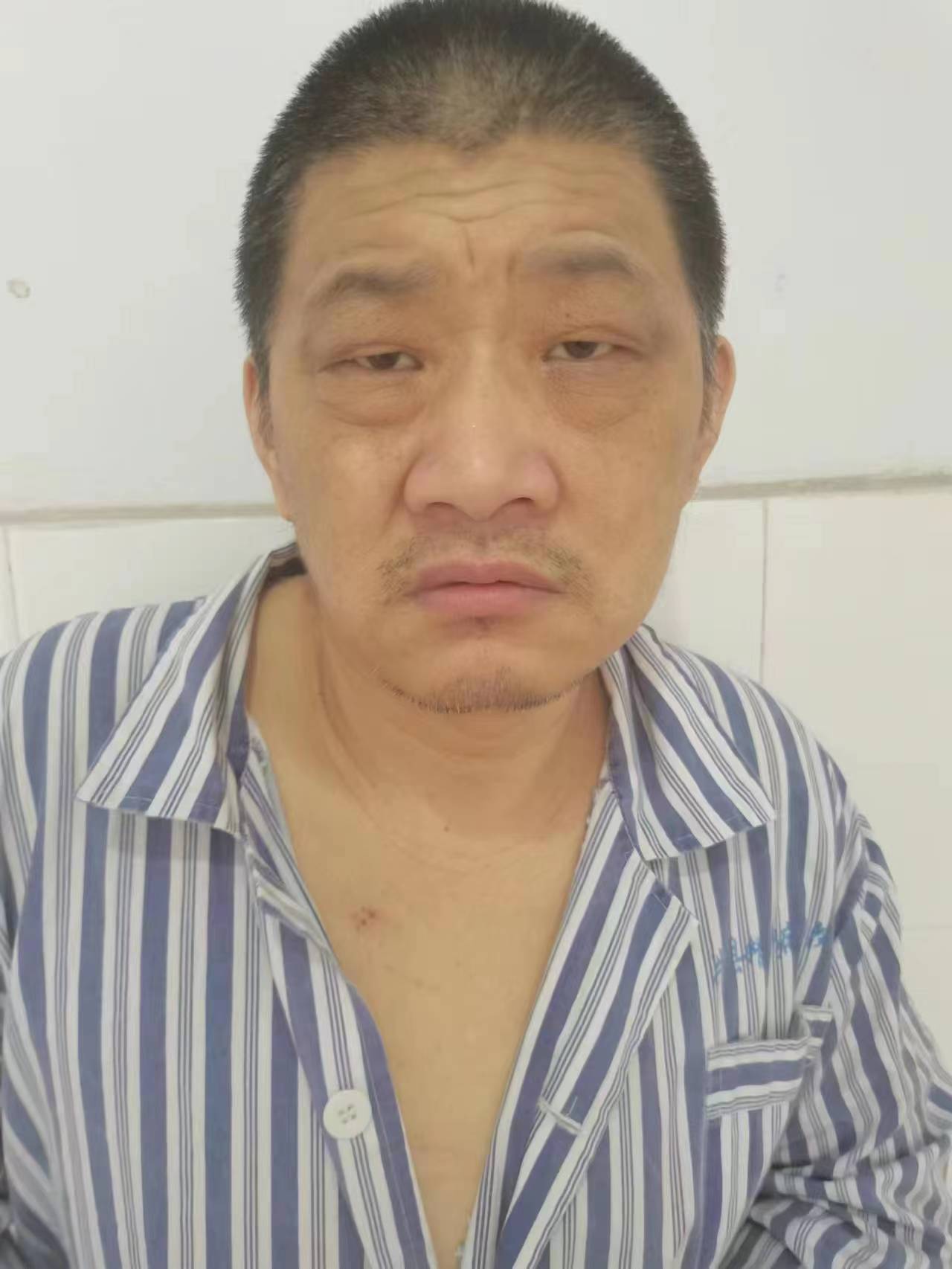 走失者照片 邯郸寻亲：中年男子被救助，高1米7...