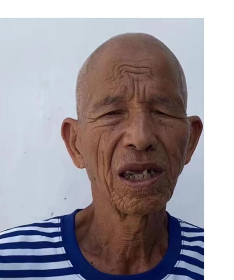 走失者照片 海南临高寻亲：六旬老人被救助，穿黑...