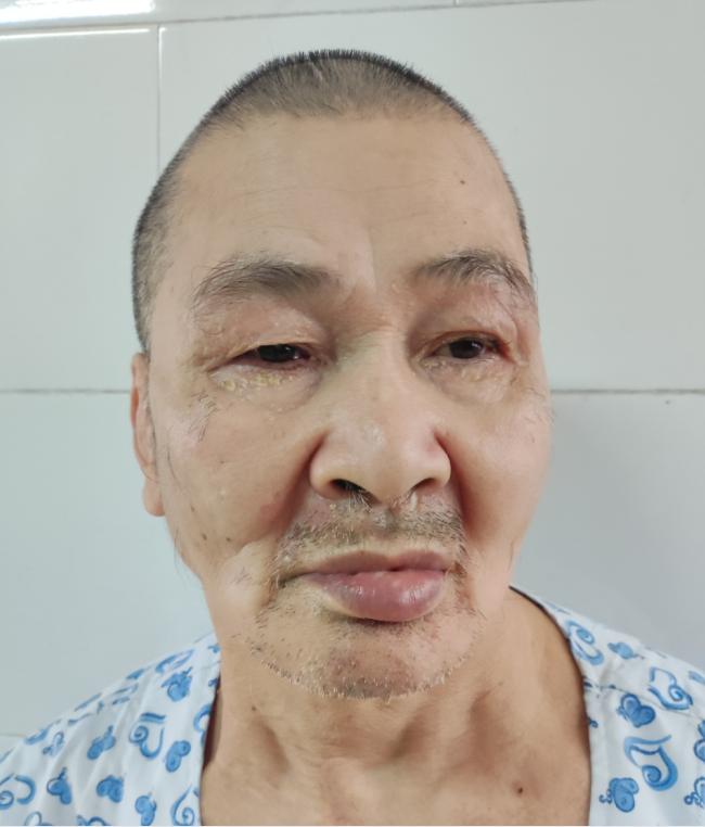 走失者照片 南宁寻亲：六旬老人在广州被救助，高...
