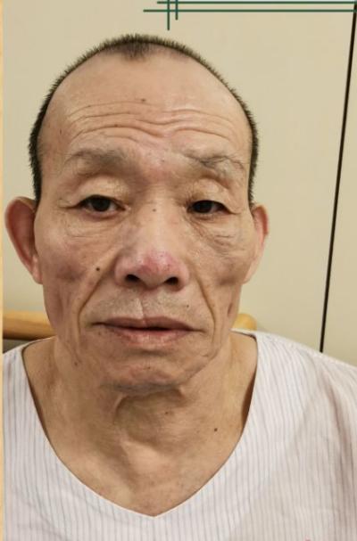 走失者照片 深圳市寻亲：五旬男子被救助多年，自...