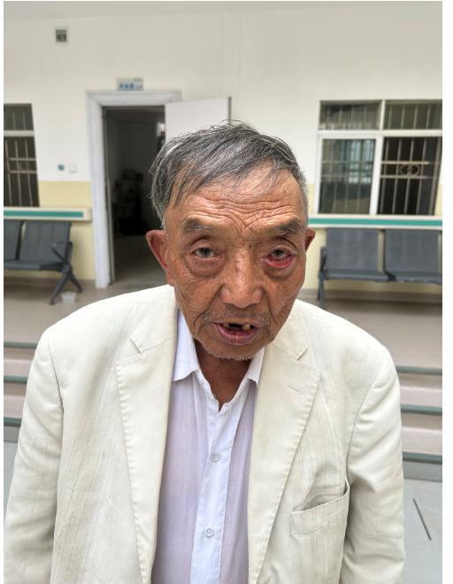 走失者照片 昆明寻亲：八旬老人被救助，戴黑色帽...