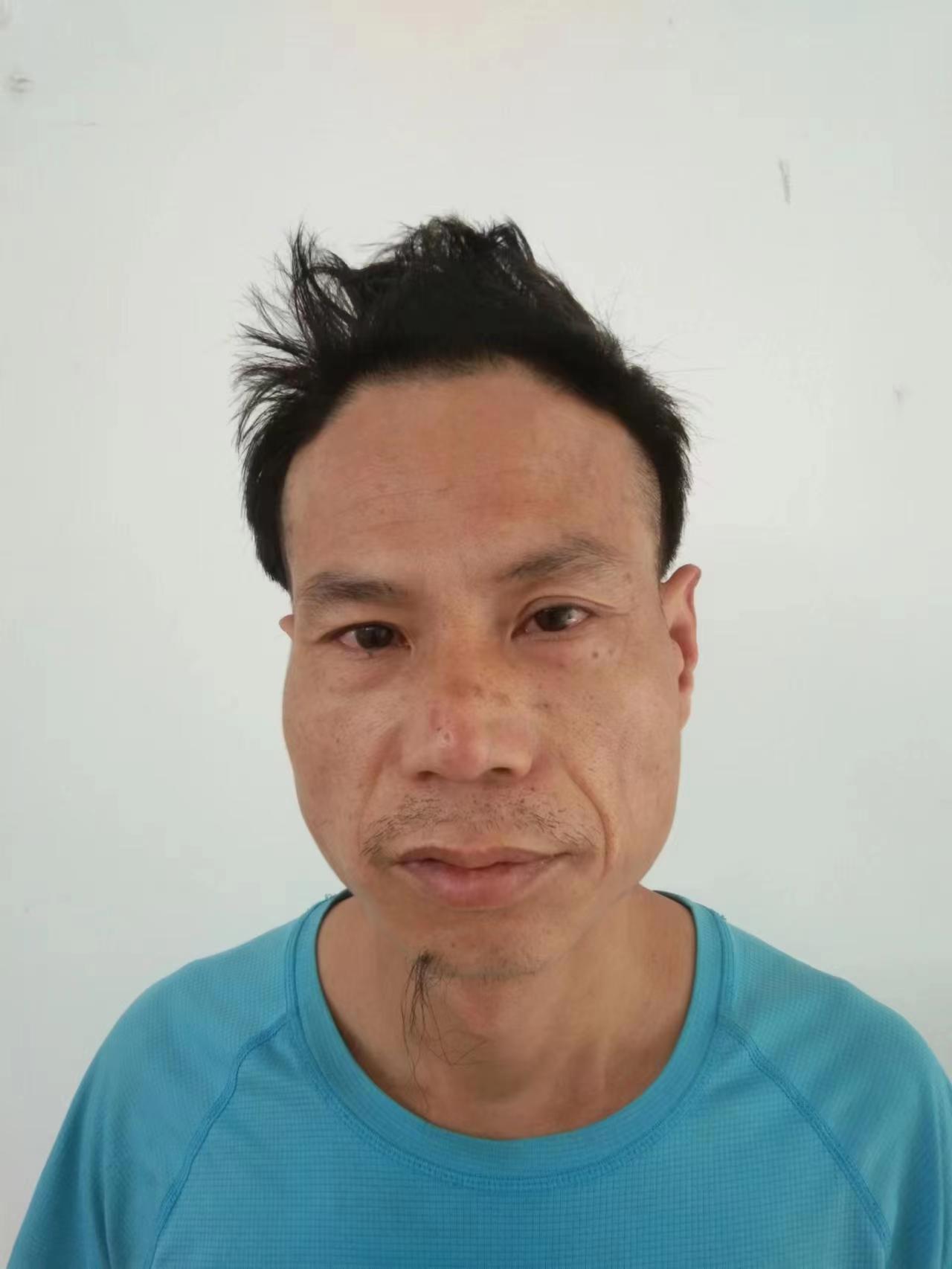 走失者照片 郴州市寻亲：青年男子被救助，自述叫...