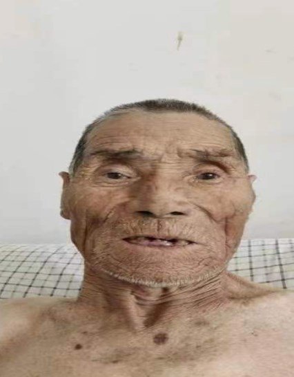 走失者照片 泰安寻亲：八旬老人被救助，高1米7...
