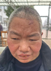 走失者照片 南阳市寻亲：六旬老太被救助，高1米...