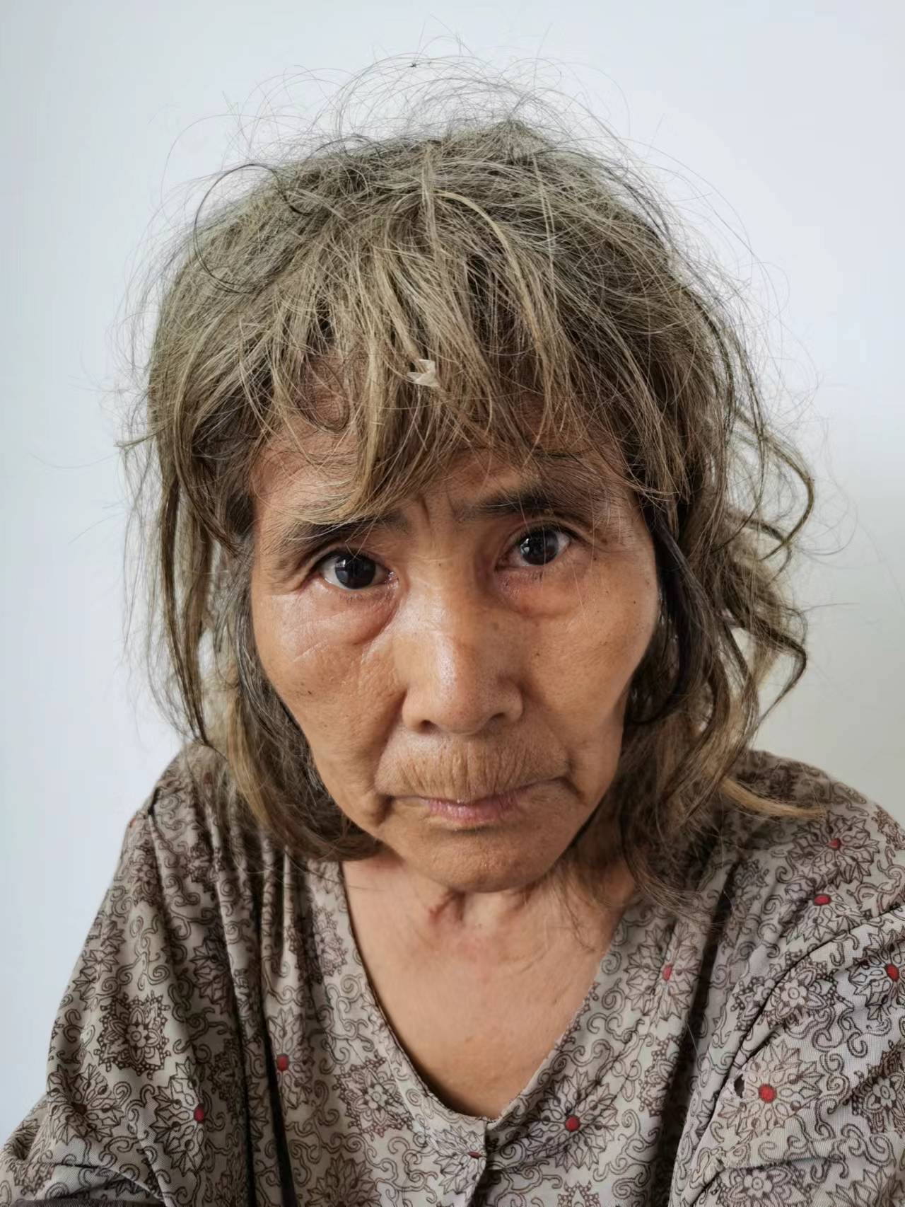 走失者照片 来宾市寻亲：五旬女子被救助，疑似精...