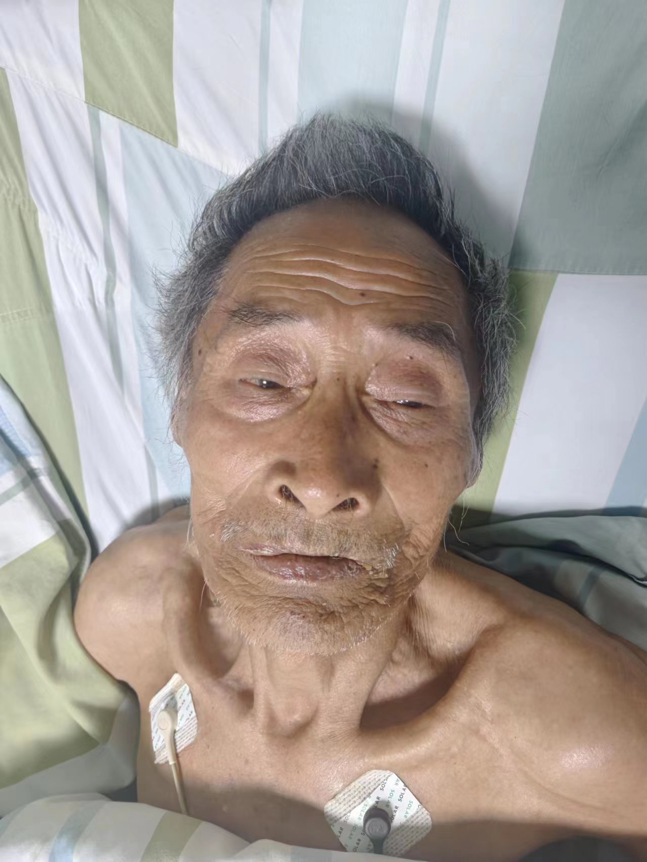 走失者照片 帮他回家：荆州八旬老人被送医，花白...