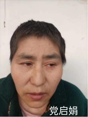 走失者照片 寻亲：菏泽五旬女子被救助，疑患精神...