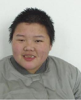 走失者照片 寻亲：青年女子在菏泽被救助多年，疑...