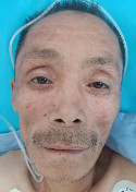 走失者照片 临沂市寻亲：五旬男子被救助，穿蓝色...