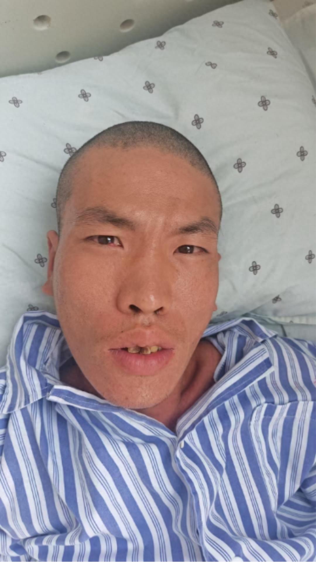 走失者照片 绍兴市诸暨市寻亲：青年男子被救助，...