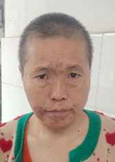 走失者照片 开封寻亲：五旬女子被救助，高1米6...