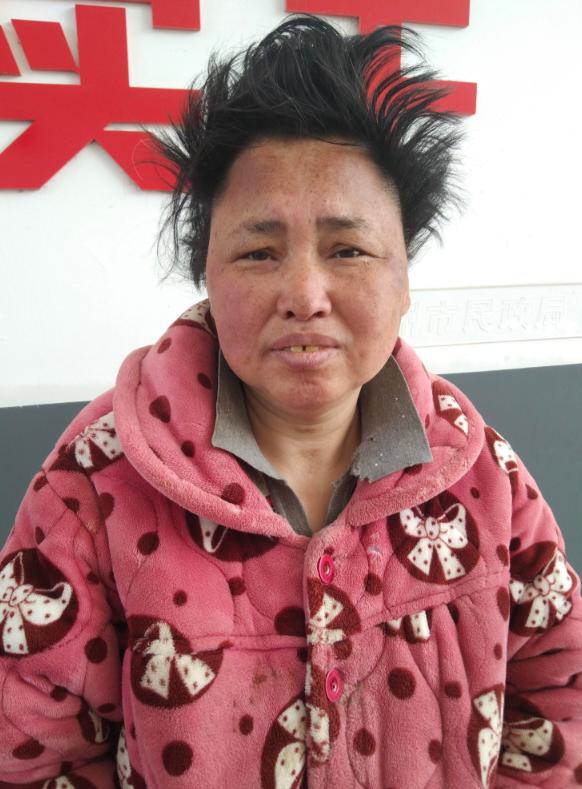 走失者照片 滁州明光市寻亲：五旬女子在亳州被救...