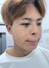 走失者照片 宿迁市寻亲：16岁少年被救助，穿白...