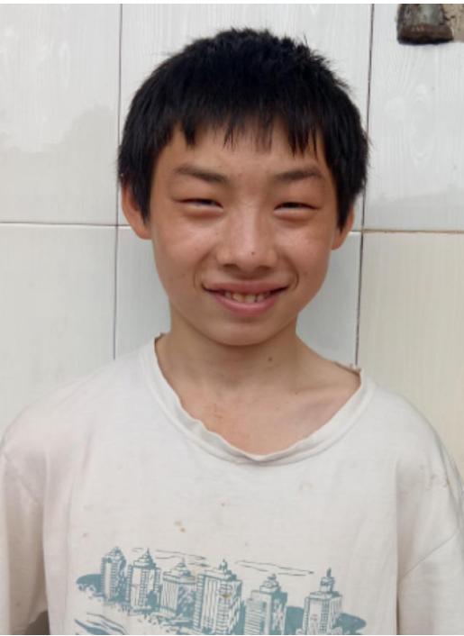 走失者照片 宁波寻亲：青年男子被长期救助，自述...
