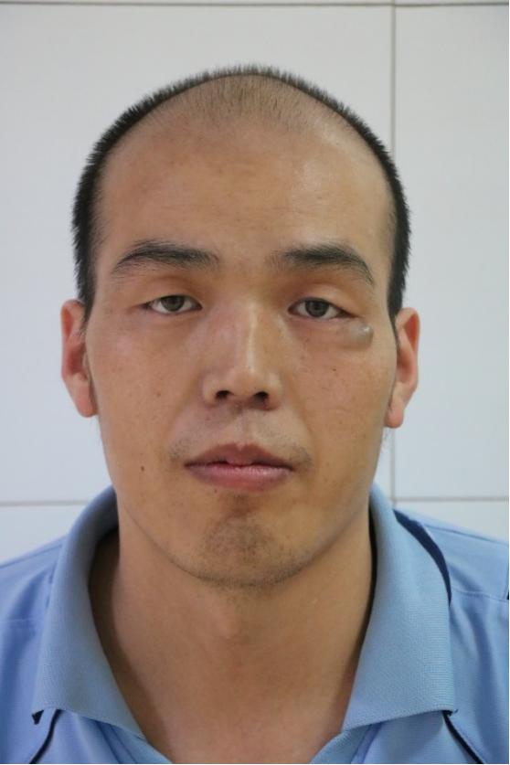 走失者照片 乌鲁木齐市寻亲：青年男子被救助，自...