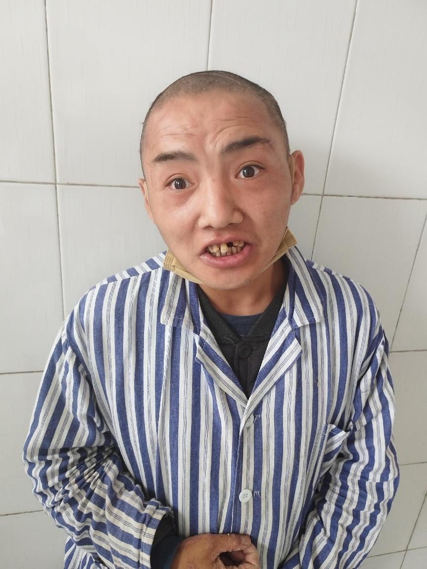 走失者照片 淄博寻亲：青年男子被救助，智力异常...