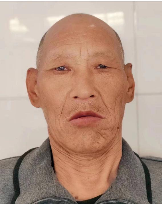 走失者照片 北京寻亲：七旬老人被救助多年，名叫...