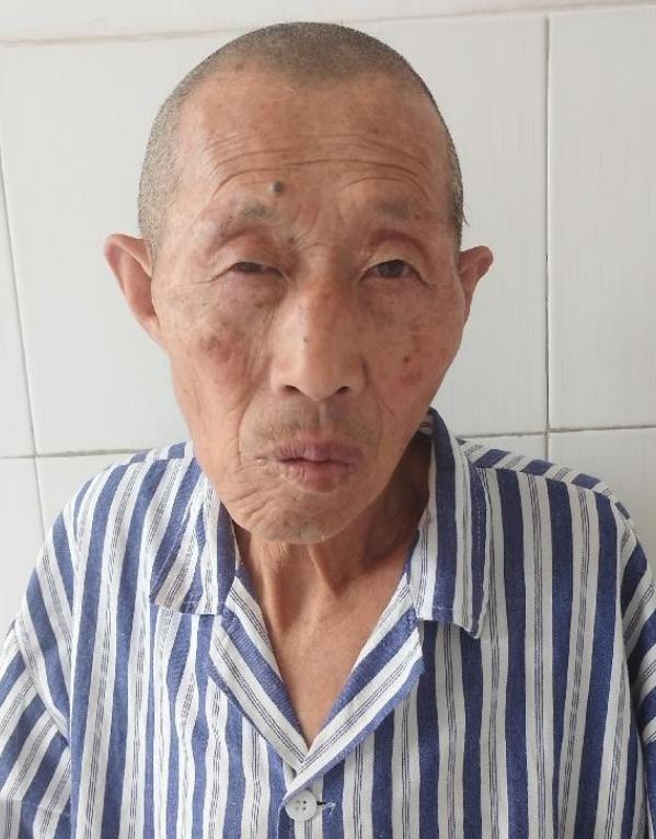 走失者照片 淄博寻亲：五旬男子被救助，高1米7...
