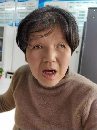 走失者照片 宿州寻亲：中年女子被救助数月，疑似...