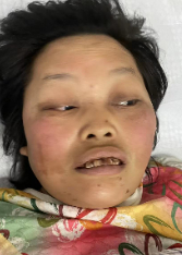 走失者照片 衡阳耒阳市救助站：中年女子被救助，...