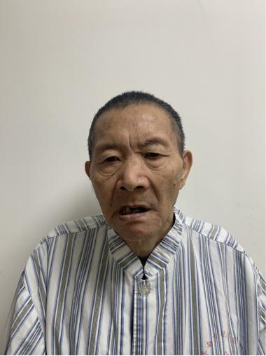 走失者照片 济南市寻亲：五旬男子被救助，左脸处...