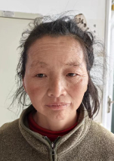 走失者照片 昭通寻亲：五旬女子被救助，自述叫张...